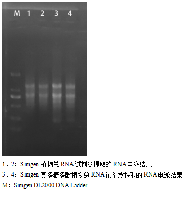 simgen-植物總RNA試劑盒-高多糖多酚植物總RNA試劑盒-電泳結果圖