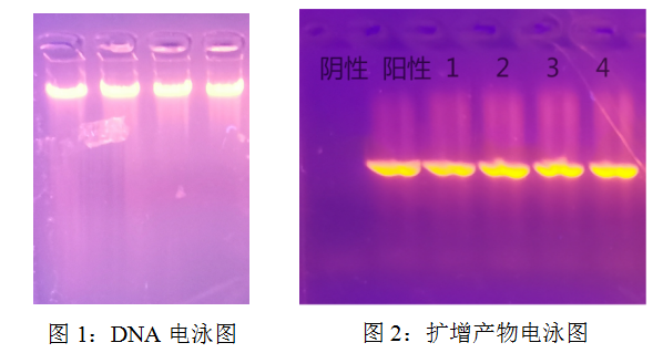 simgen-快速全血DNA小量試劑盒-2×PCR Mix -Sim-100超微量分光光度計- 電泳圖