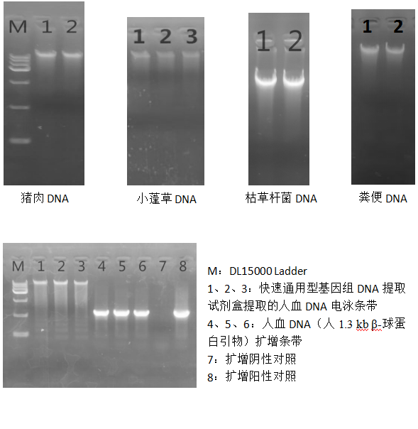 快速通用型基因組DNA提取試劑盒-2×PCR Mix-溶菌酶-電泳結果圖一