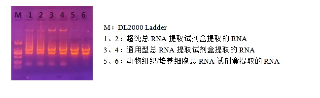 Simgen超純總RNA提取試劑盒—電泳條帶